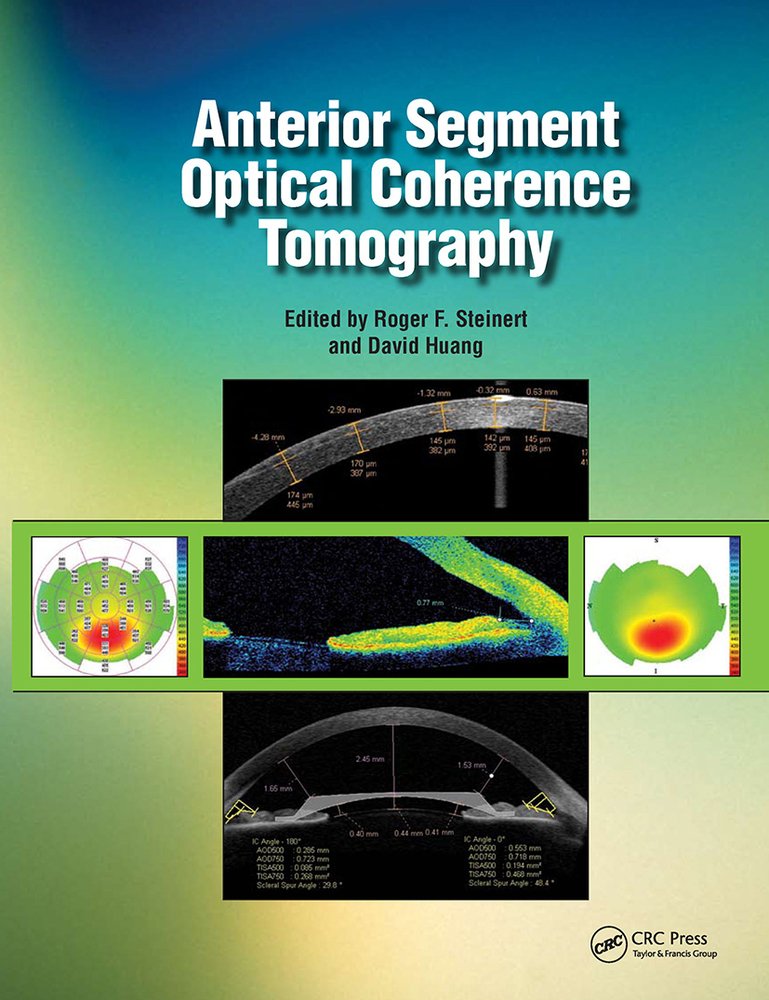 Anterior Segment Optical Coherence Tomography a book by Roger Steinert ...