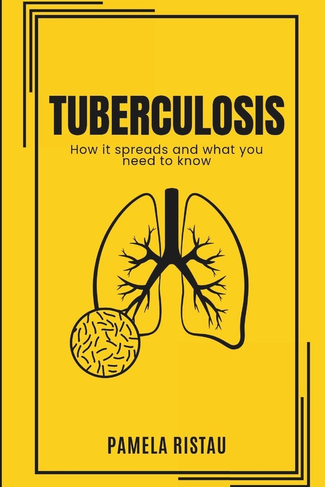 Tuberculosis a book by Pamela Ristau - Bookshop.org US