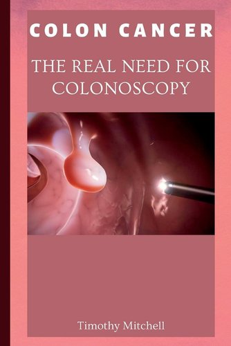 Colon Cancer: The Real Need for Colonoscopy a book by Timothy Mitchell